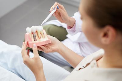 A woman holding a dental implant model