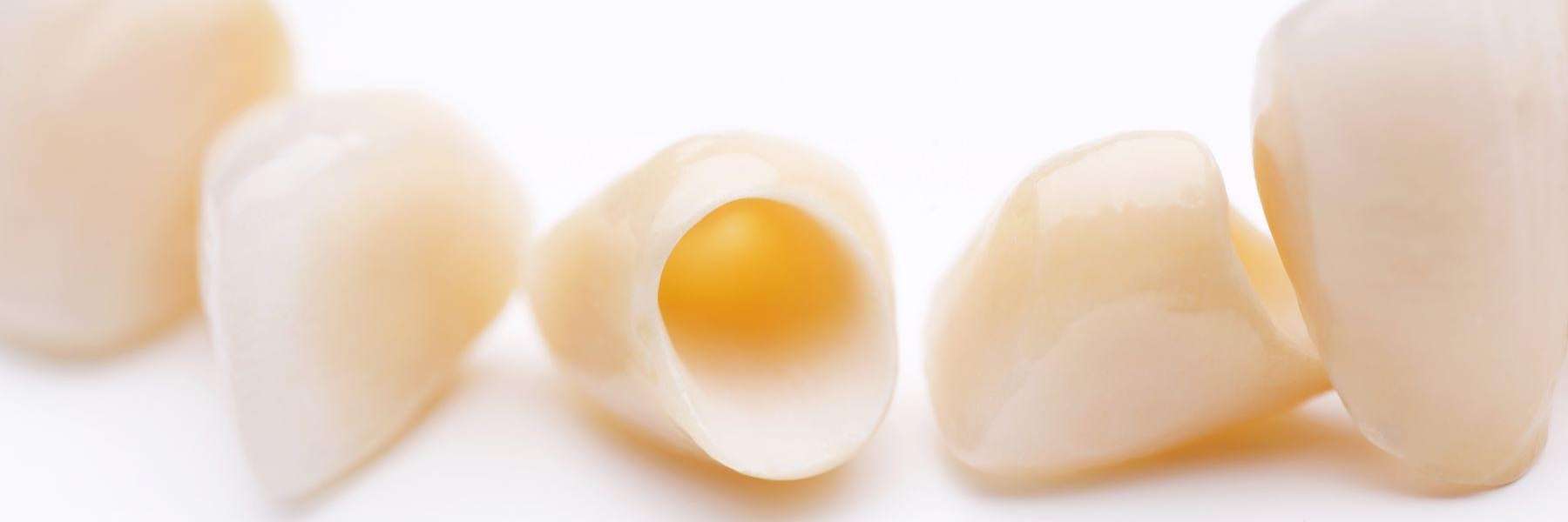 Image of dental crowns in Elk Grove CA