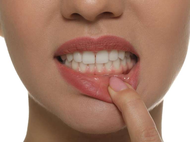 A smiling woman showing her bottom row of teeth
