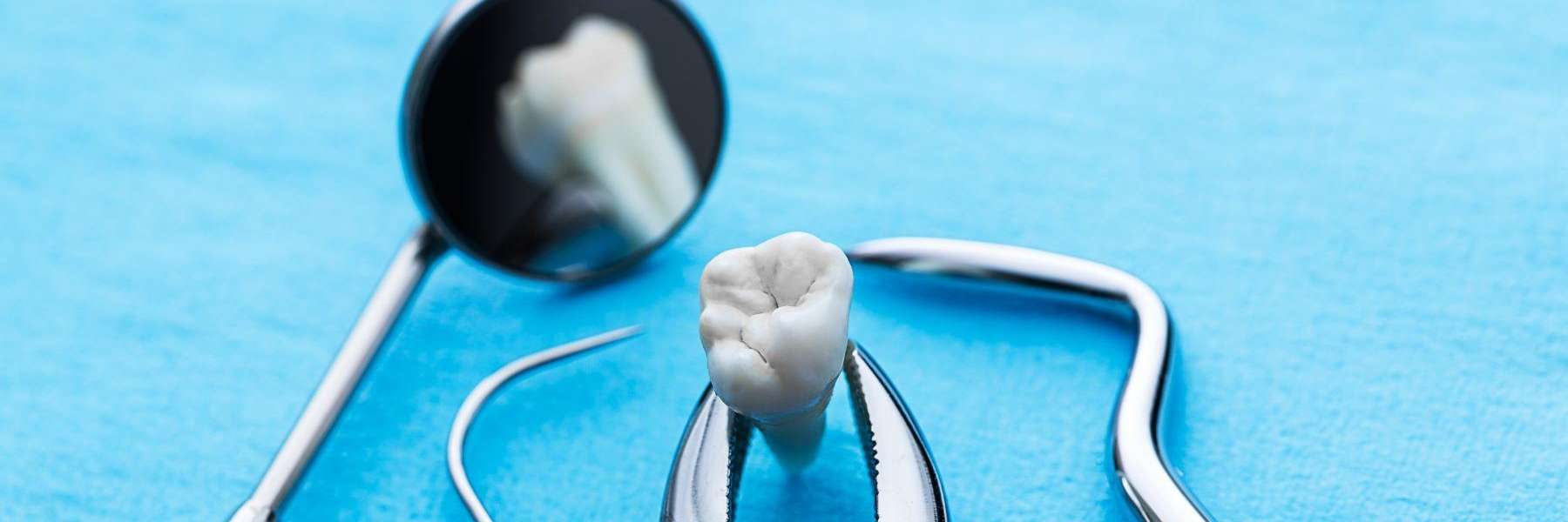 An extracted tooth