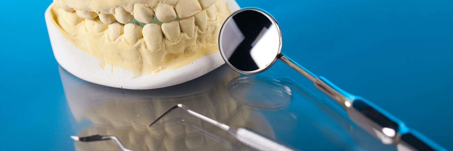 A dental mold and dental tools | dentist in Elk Grove