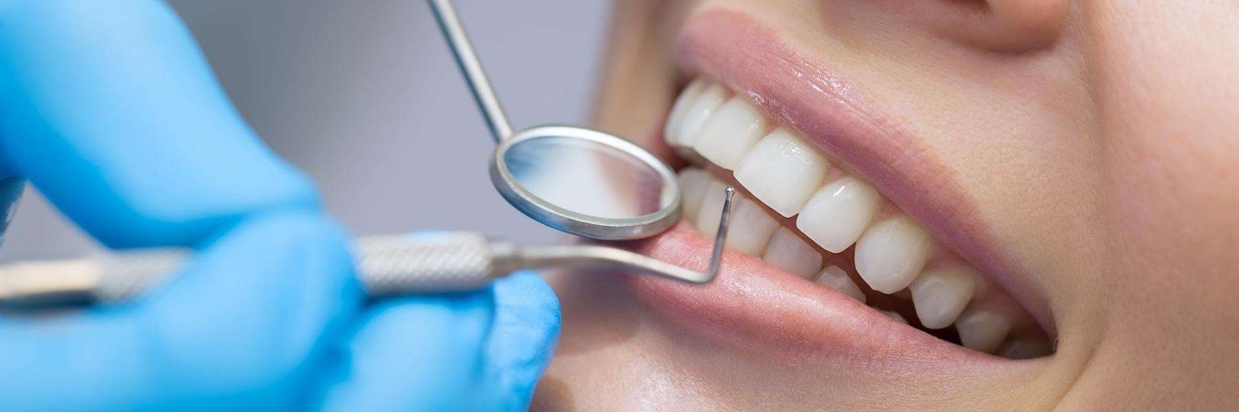 A smiling woman getting a dental exam