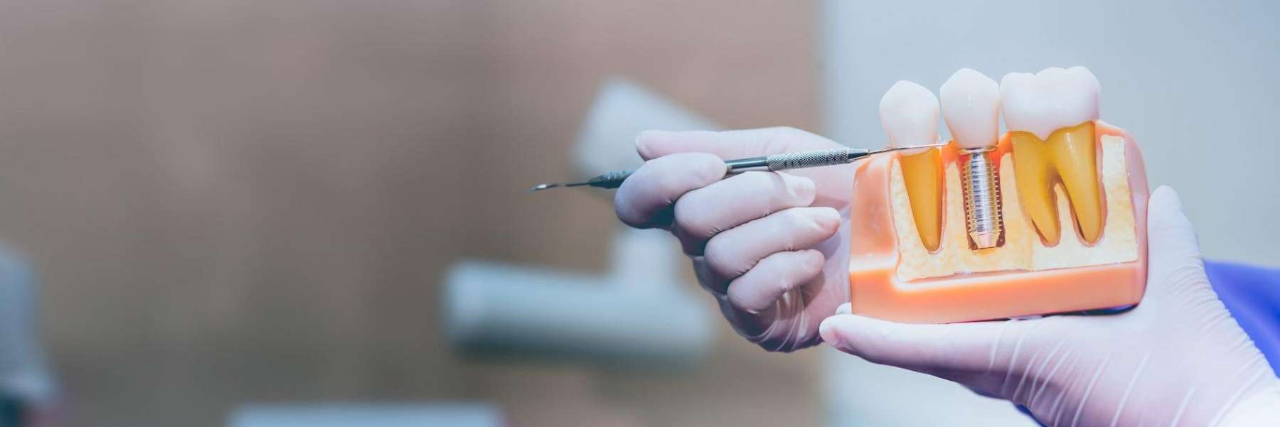 A model of a jaw and a dental implant