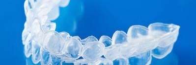 Image of an Invisalign tray