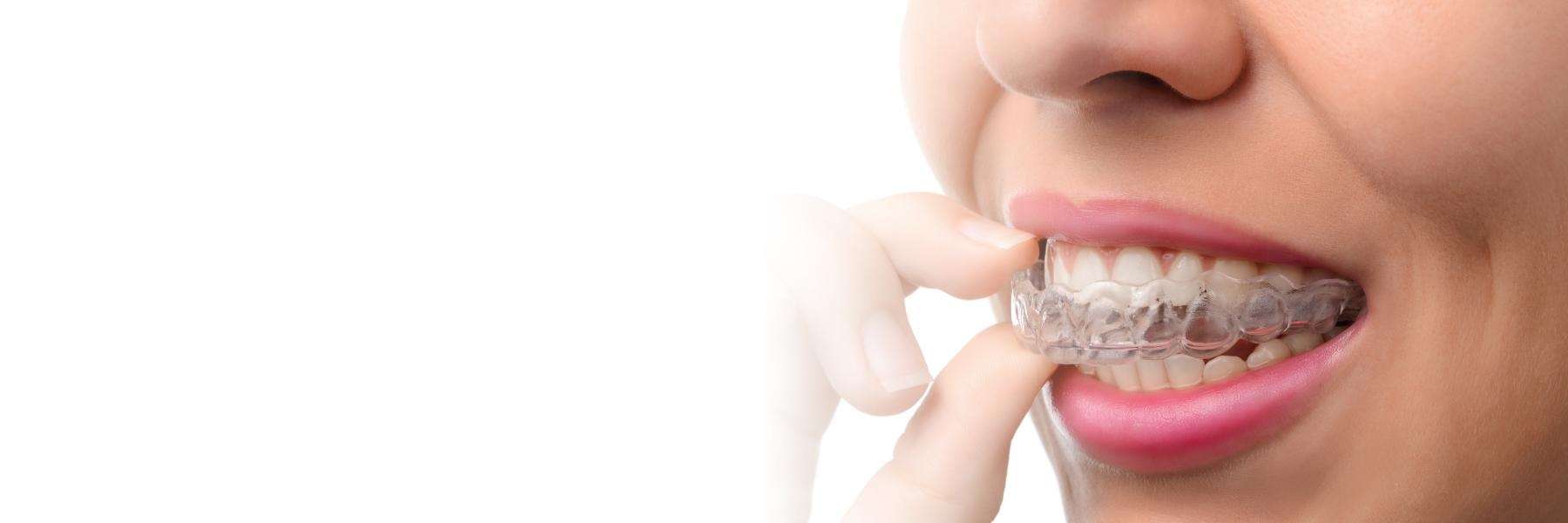 A woman removing her Invisalign tray