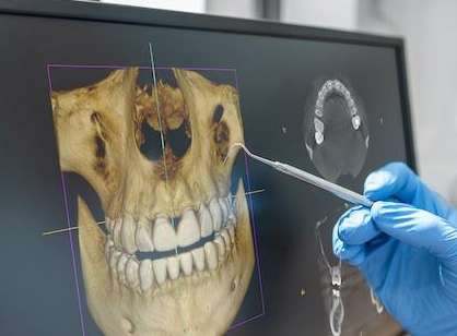 3D Cone Beam Imaging in Elk Grove