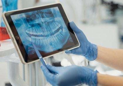 Panoramic x-rays in Elk Grove